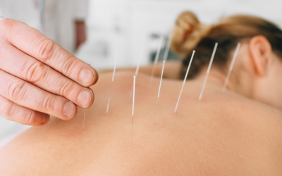Acupuncture for Fertility, Preconception, and Pregnancy Care