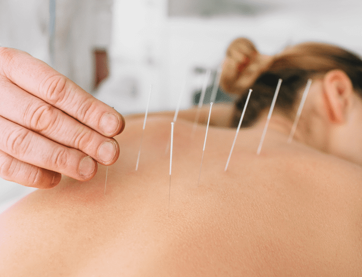 Acupuncture for Fertility, Preconception, and Pregnancy Care